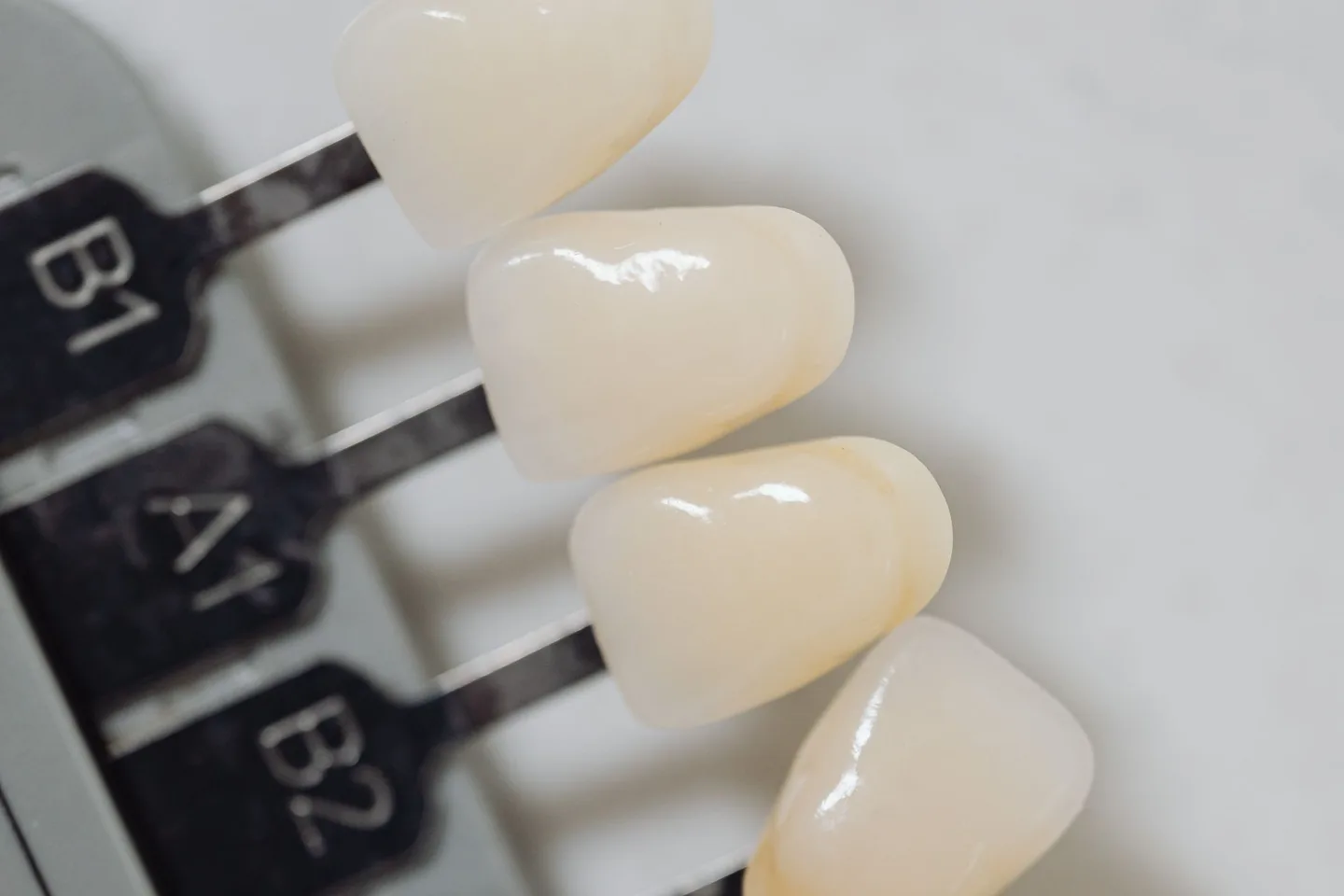 Close-up of physical B1, A1, B2 and D2 tooth shade tabs