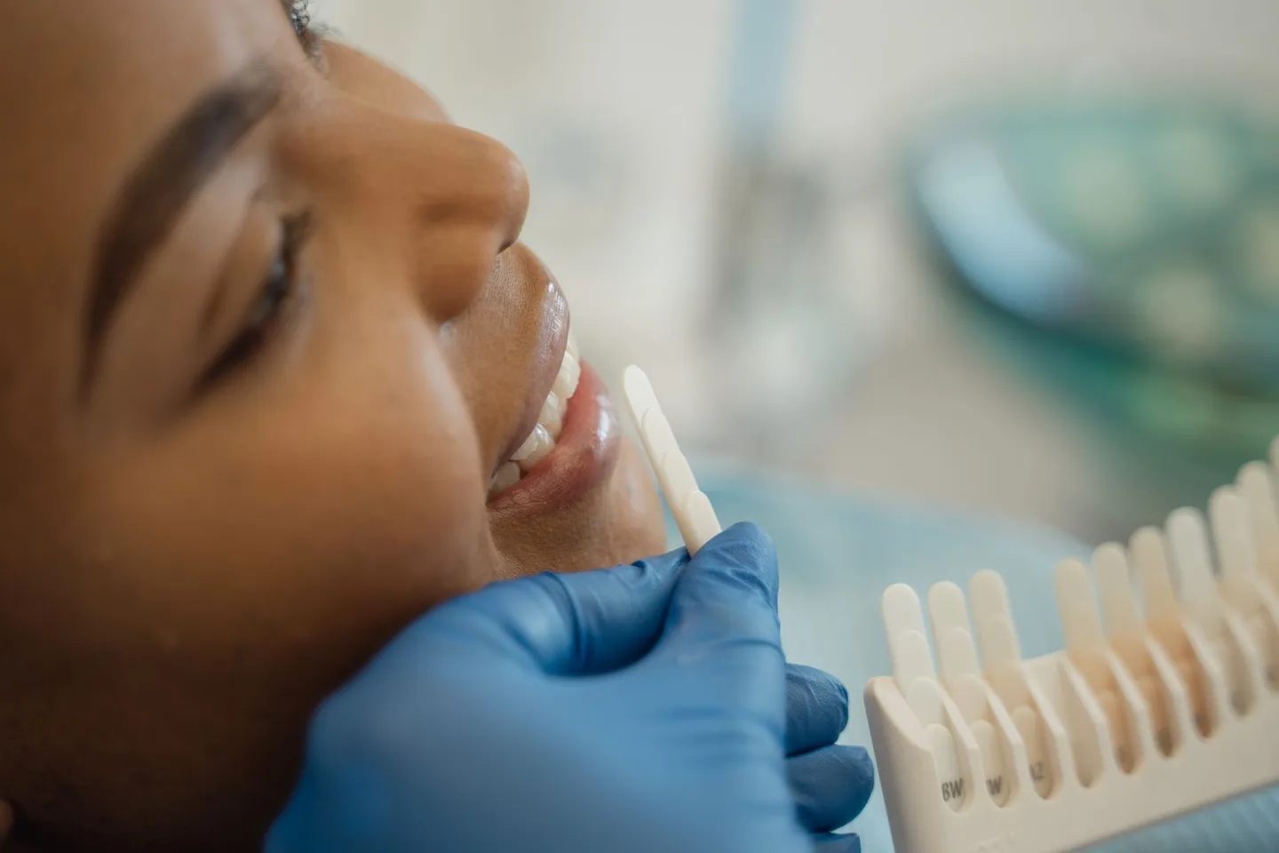 Dental professional comparing a shade sample beside a patient's natural teeth