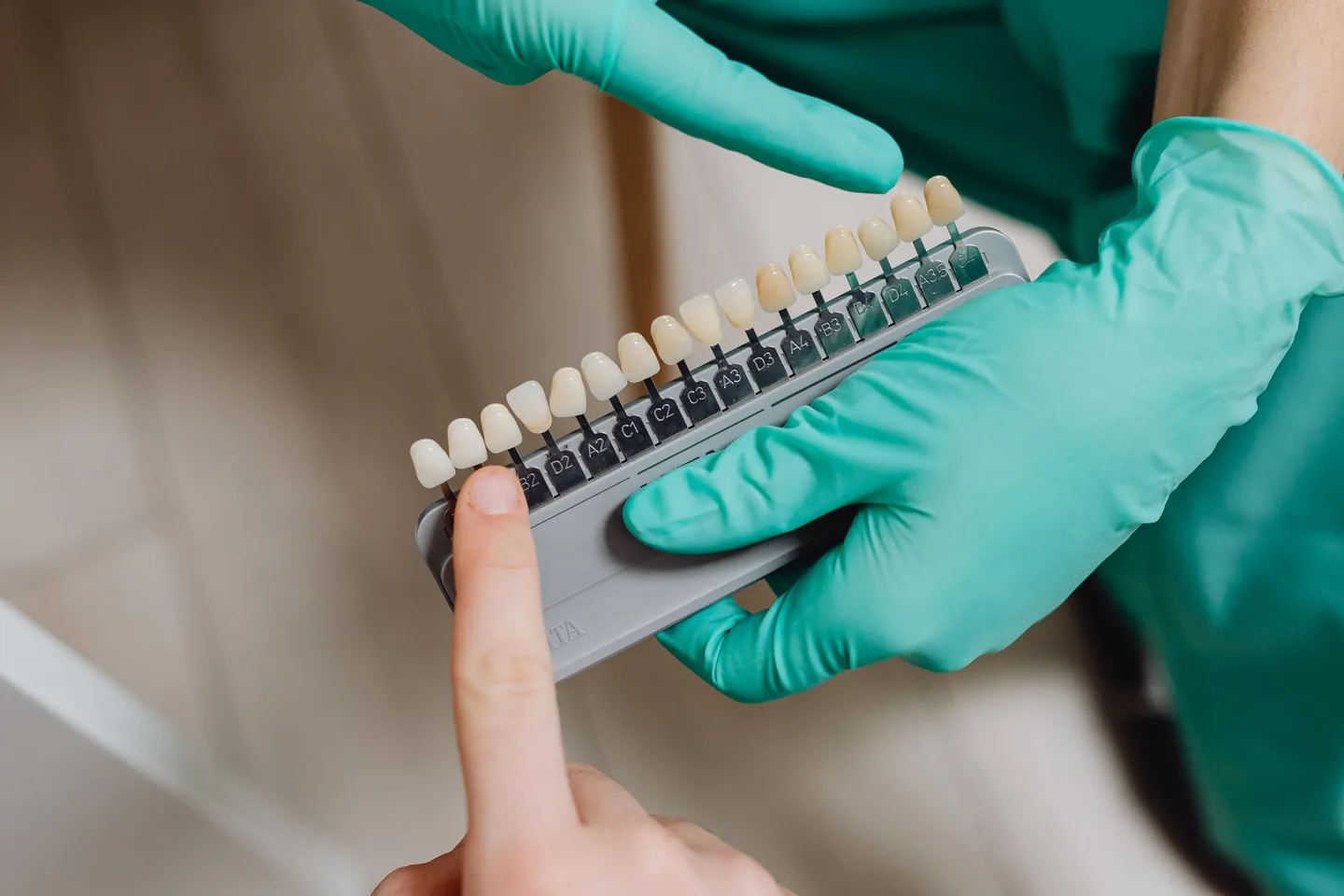 Patient and dental professional pointing to a physical tooth shade guide