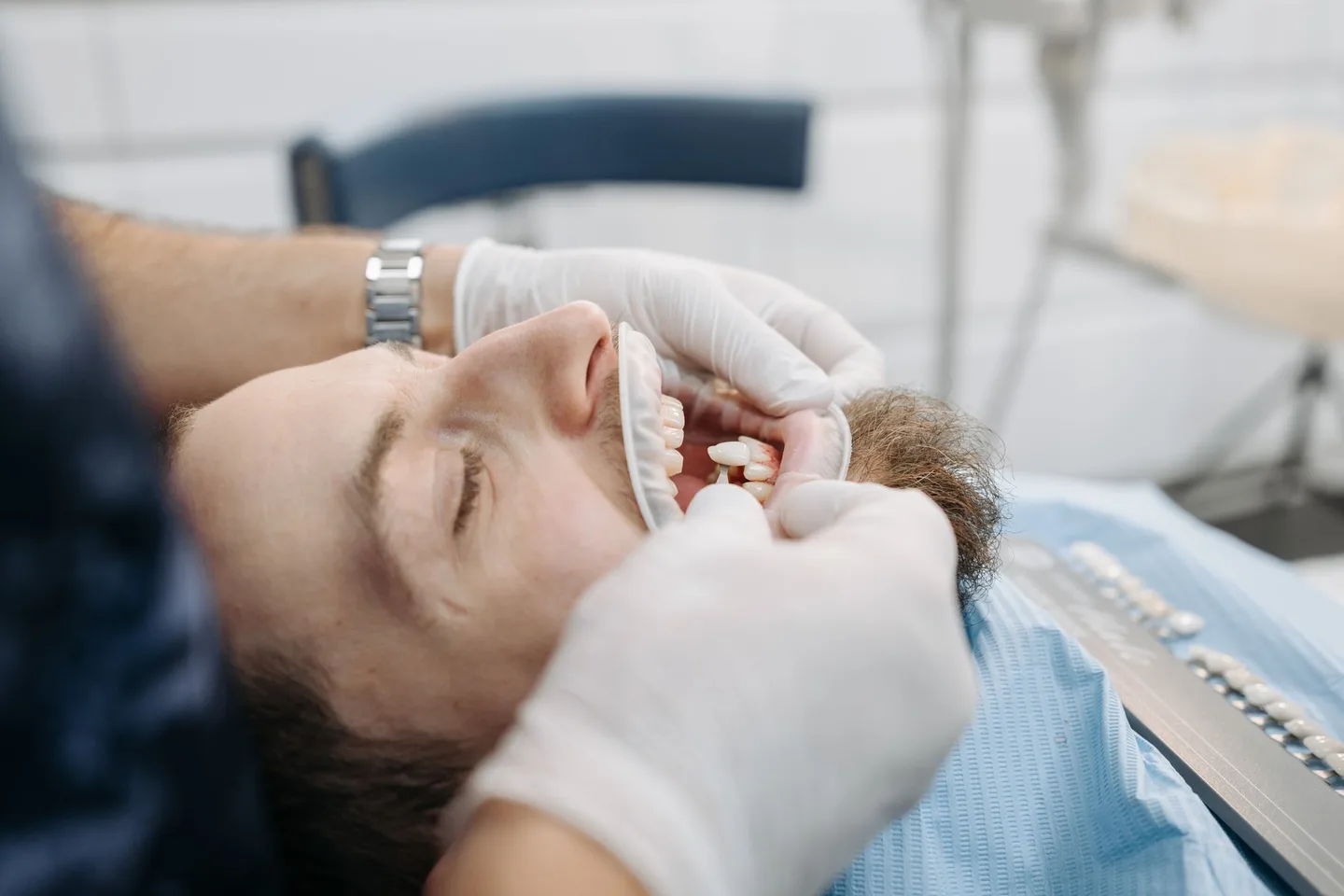 Dentist comparing a physical tooth shade sample beside a patient's teeth
